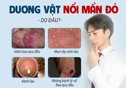 Đầu dương vật nổi mẩn đỏ ngứa – Cảnh giác 8 bệnh nguy hiểm