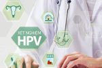Khi nào cần xét nghiệm HPV? Địa chỉ xét nghiệm HPV uy tín