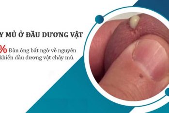 [Dương vật chảy mủ] Dấu hiệu cảnh báo 4 bệnh nguy hiểm