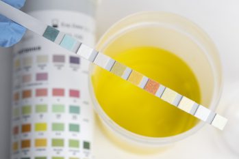 Giải đáp tiểu ra mủ màu xanh hoặc vàng nguyên nhân do đâu và cách chữa trị