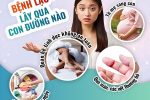 Giải mã bệnh lậu: Nguyên nhân, triệu chứng và phương pháp xử lý tối ưu