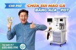Chi phí chữa sùi mào gà bằng ALA – PDT hết bao nhiêu?