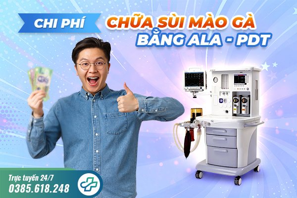 Chi phí chữa sùi mào gà bằng ALA – PDT hết bao nhiêu?