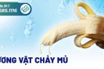 Dương vật chảy mủ cẩn thận bạn đã mắc bệnh xã hội