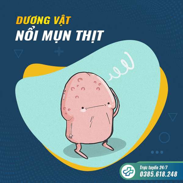 [Cảnh báo] Dương vật nổi mụn thịt dấu hiệu bệnh lý nguy hiểm