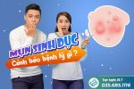 Mụn sinh dục cảnh báo bệnh lý gì? Có nguy hiểm không?
