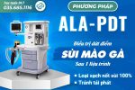Hỗ trợ điều trị hiệu quả bệnh sùi mào gà bằng phương pháp ALA-PDT