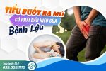 [Chuyên gia giải đáp]: Tiểu ra mủ có phải là biểu hiện của bệnh lậu không?