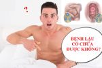 Bệnh lậu có chữa được không? Giải đáp từ chuyên gia nam khoa