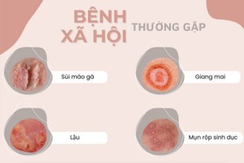 Gợi ý địa chỉ phòng khám bệnh xã hội uy tín, chất lượng tại TPHCM