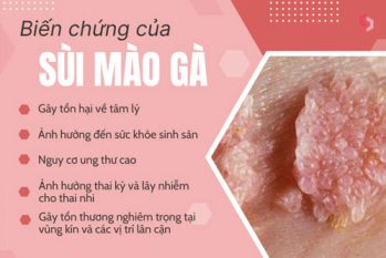 Đừng chủ quan! Biến chứng sùi mào gà có thể để lại hậu quả kéo dài