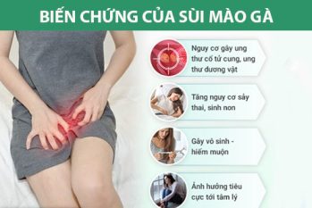 Bệnh sùi mào gà có nguy hiểm không? Dấu hiệu cảnh báo bạn cần khám ngay