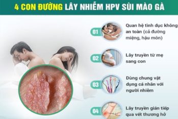 Giải đáp: Sùi mào gà lây qua đường gì và cách phòng ngừa hiệu quả