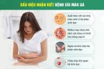 Cảnh giác: Dấu hiệu nhận biết bệnh sùi mào gà là gì và hậu quả nếu bỏ qua