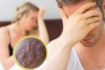 Mụn rộp dương vật: Dấu hiệu nguy hiểm nam giới không nên coi thường