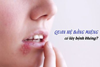 Nguy cơ từ bệnh quan hệ bằng miệng – Sự thật khiến nhiều người giật mình