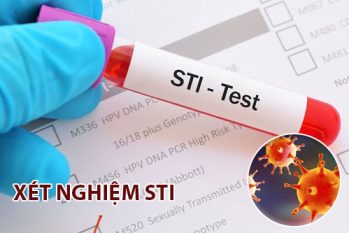 Xét nghiệm STIs là gì? Khi nào nên thực hiện xét nghiệm?