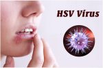 Cách hỗ trợ điều trị HSV hiệu quả, chỉ với 1 lần thực hiện