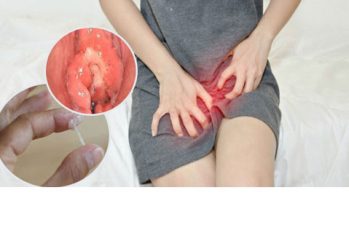 Nguyên nhân gây lở loét vùng kín ở nam giới và nữ giới