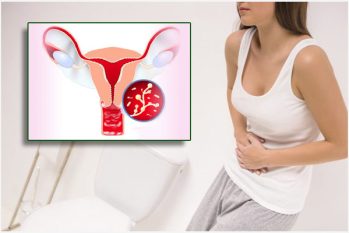 Nhiễm khuẩn sinh dục: Dấu hiệu nhận biết và Cách hỗ trợ điều trị hiệu quả