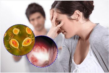 Những viêm nhiễm sinh dục thường gặp ở nam và nữ giới